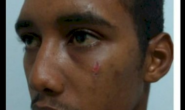 DIC solicita apoio para localizar criminoso que queimou homem vivo em Criciúma