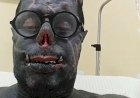 "Diabão" recebe alta após cirurgia e diz que orações o salvaram