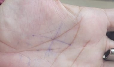 Mulher denuncia agressão através do X na Mão e homem é preso pela PM