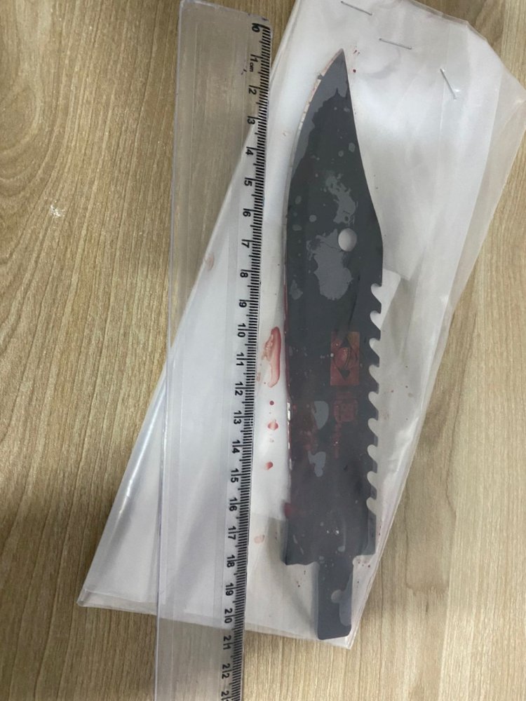 Estado terá que indenizar em R$ 15 mil professor atacado por aluno com faca