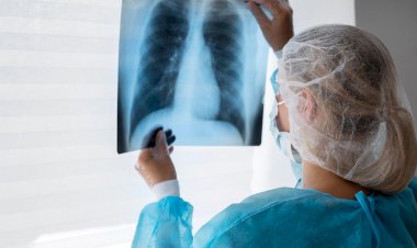 Médica do HSJosé esclarece dúvidas sobre a embolia pulmonar