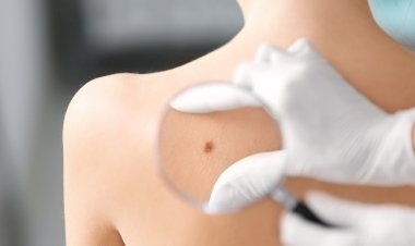 Prevenção do câncer de pele e cuidados devem continuar mesmo no inverno