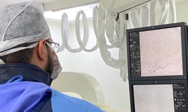 Hospital São José: tratamento inovador para doenças cerebrovasculares é realizado pela primeira vez em Santa Catarina