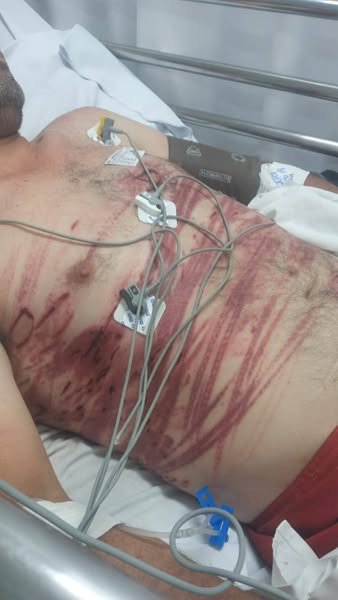 Homem leva surra por roubar idosos em bairro de Criciúma