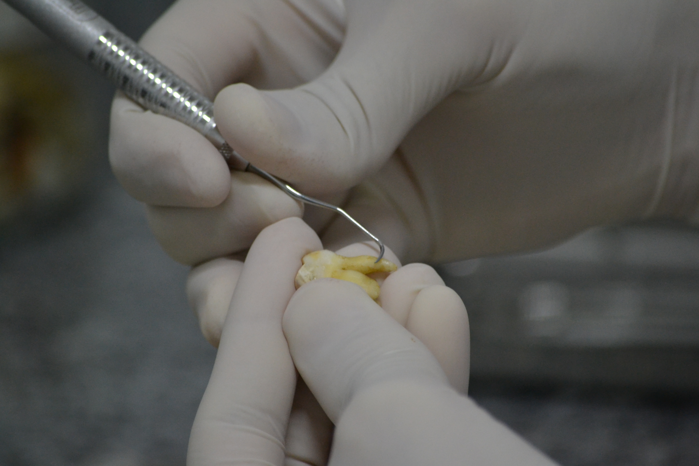 Banco de Dentes Humanos da Unesc auxilia nos estudos de acadêmicos de Odontologia