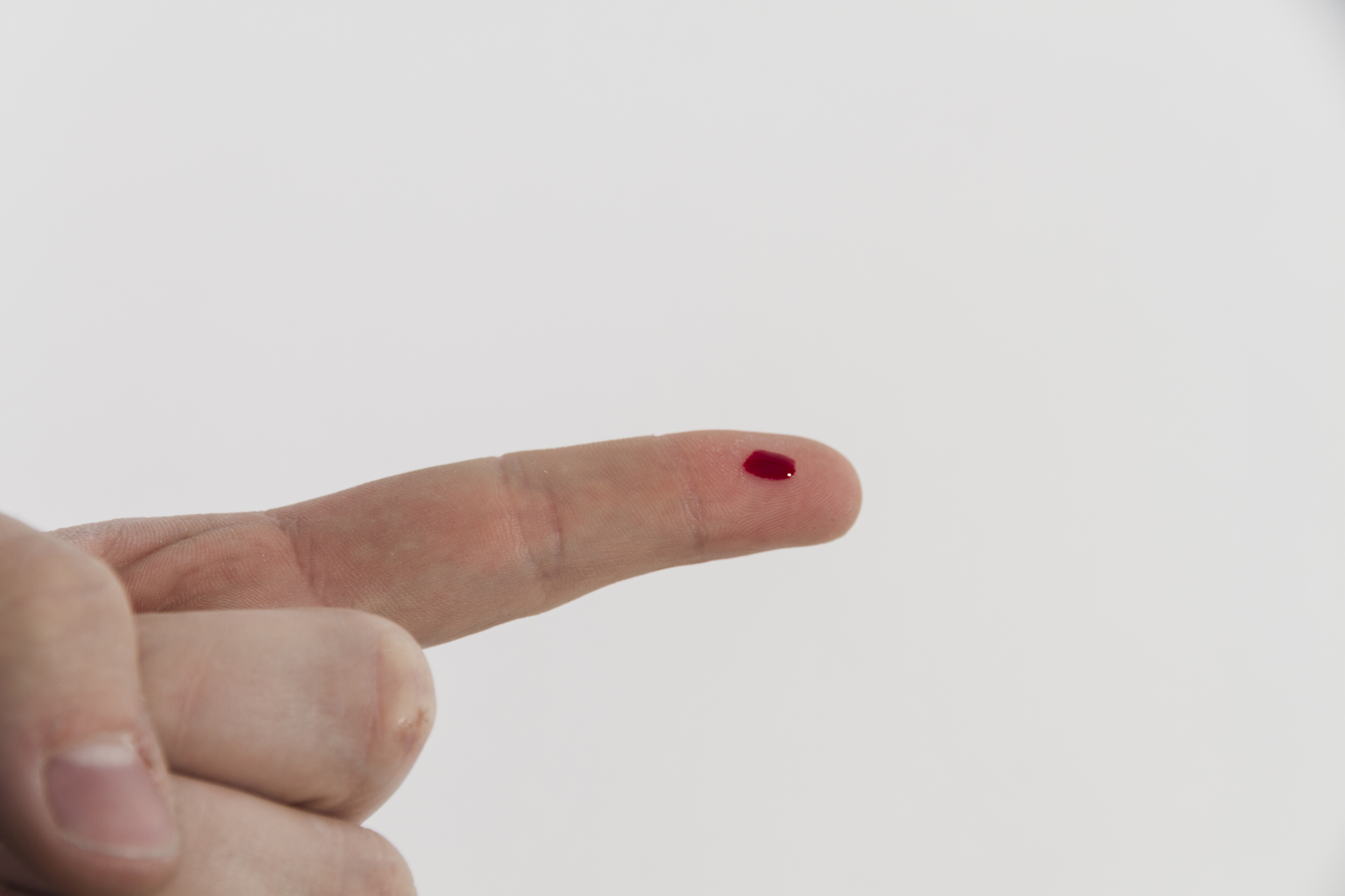 Dezembro Vermelho: Criciúma será uma das cinco cidades de Santa Catarina a receber autoteste de HIV